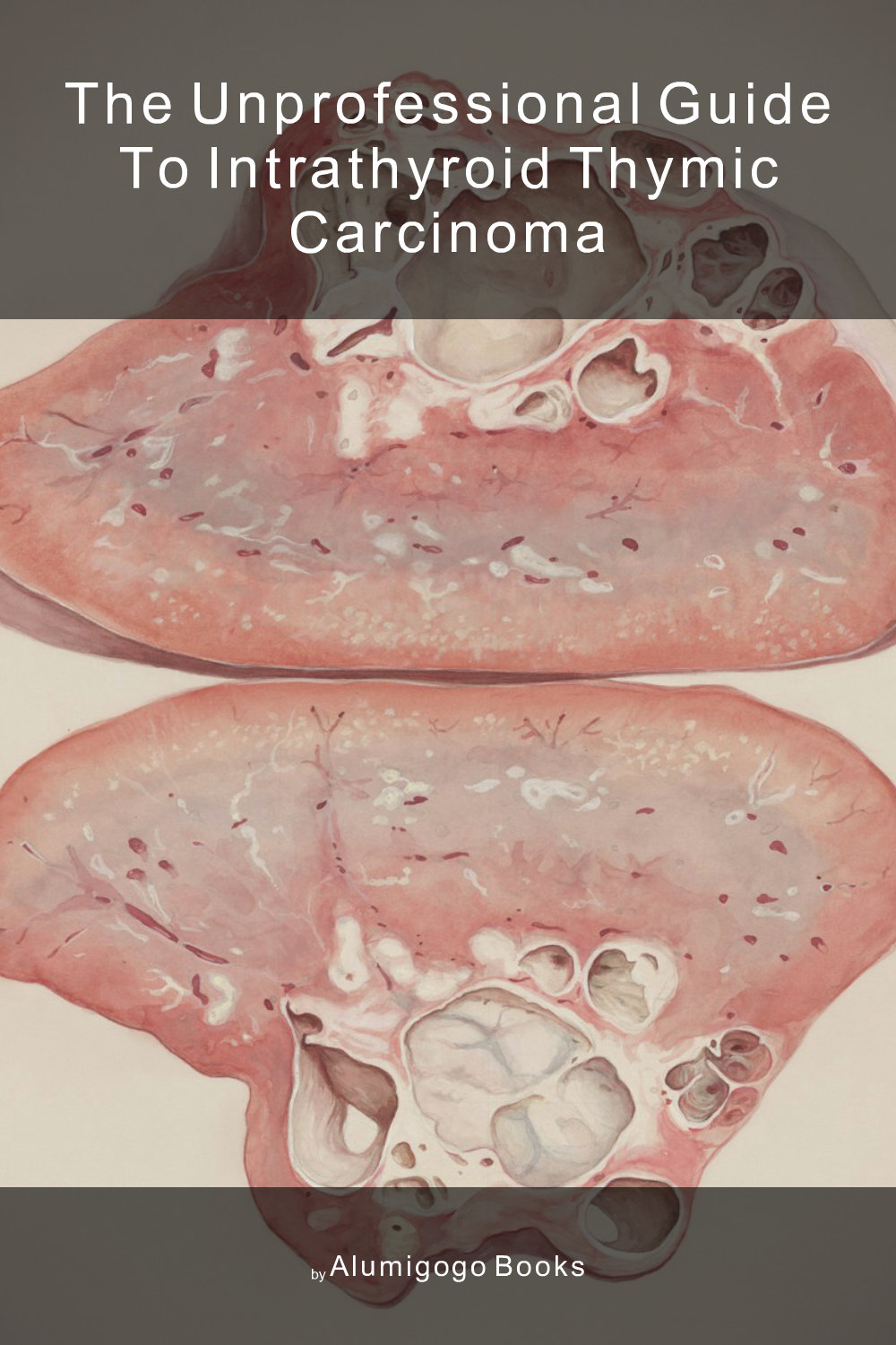 Cover of The Unprofessional Guide to intrathyroid thymic carcinoma