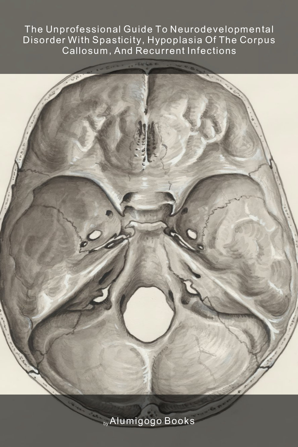 Cover of The Unprofessional Guide to neurodevelopmental disorder with spasticity, hypoplasia of the corpus callosum, and recurrent infections