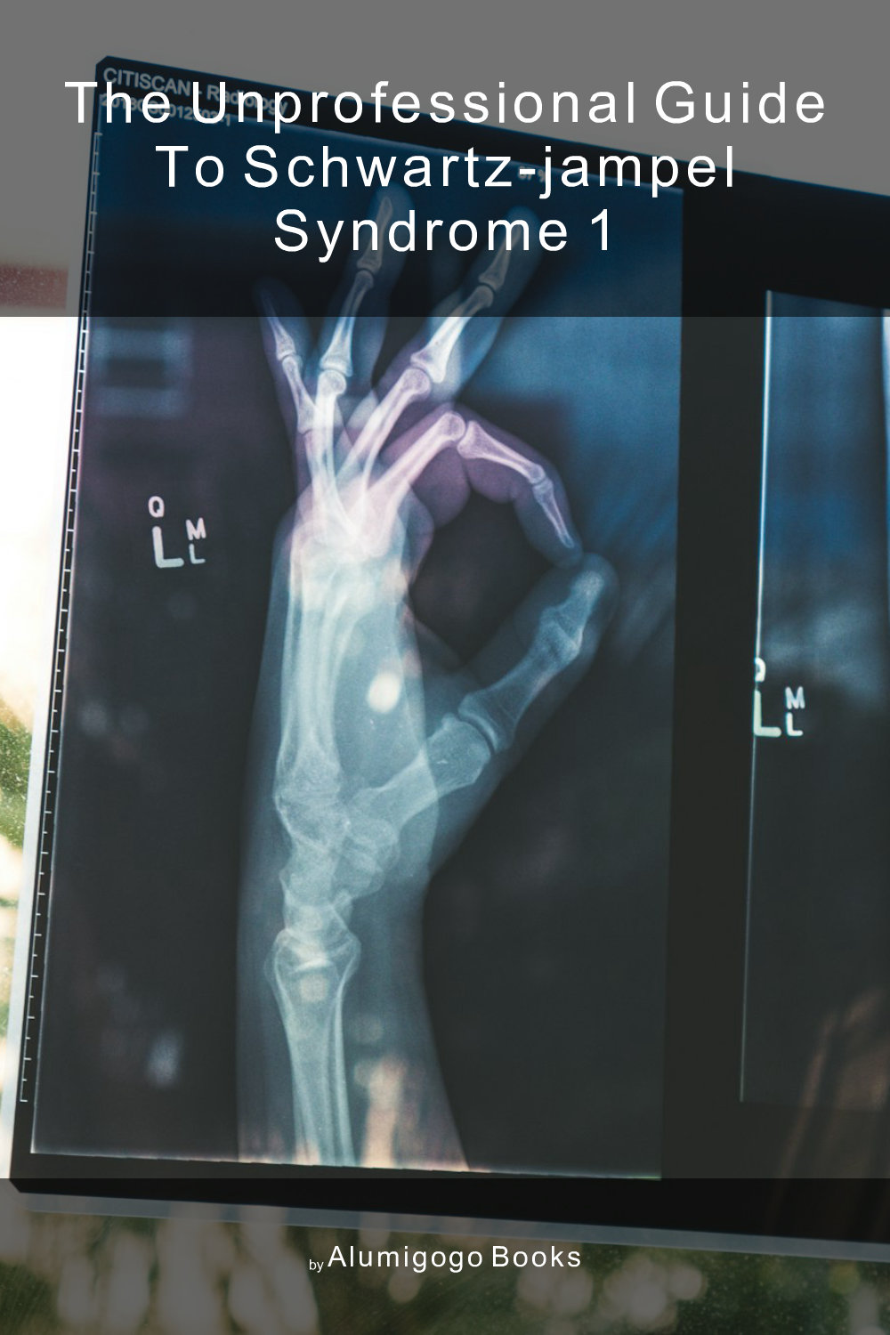 Cover of The Unprofessional Guide to Schwartz-Jampel syndrome 1