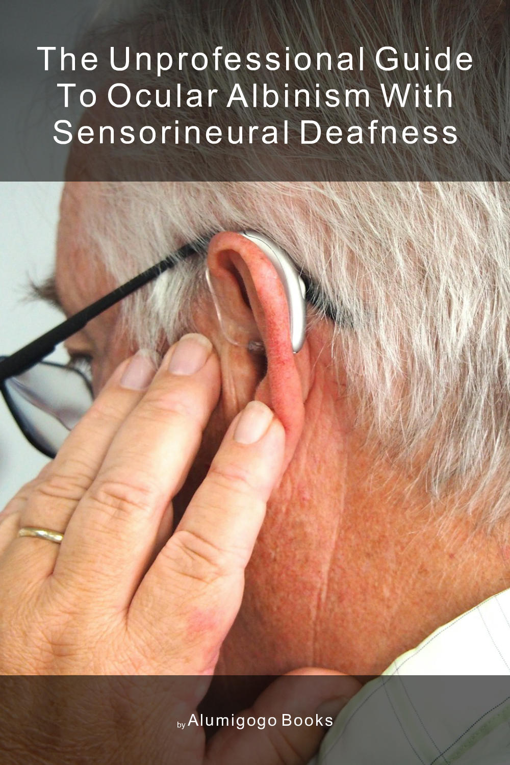 Cover of The Unprofessional Guide to ocular albinism with sensorineural deafness