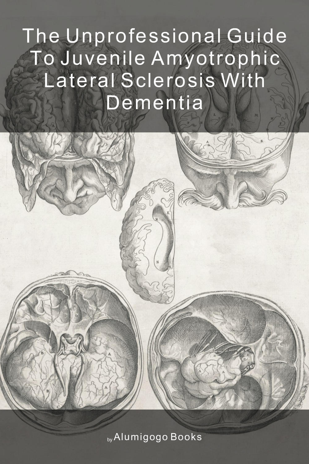 Cover of The Unprofessional Guide to juvenile amyotrophic lateral sclerosis with dementia