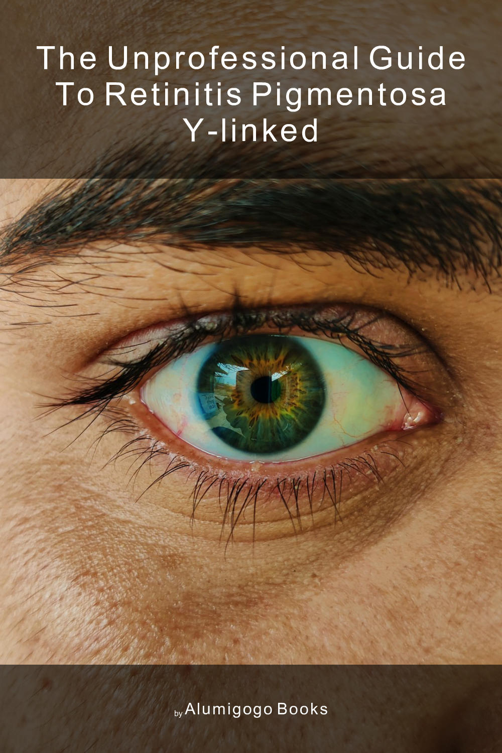 Cover of The Unprofessional Guide to retinitis pigmentosa Y-linked