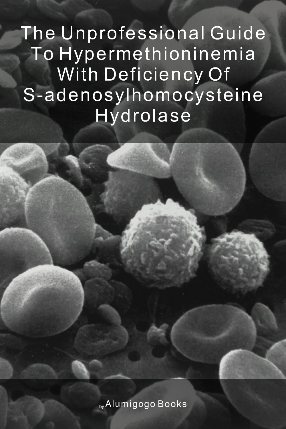 Cover of The Unprofessional Guide to hypermethioninemia with deficiency of S-adenosylhomocysteine hydrolase
