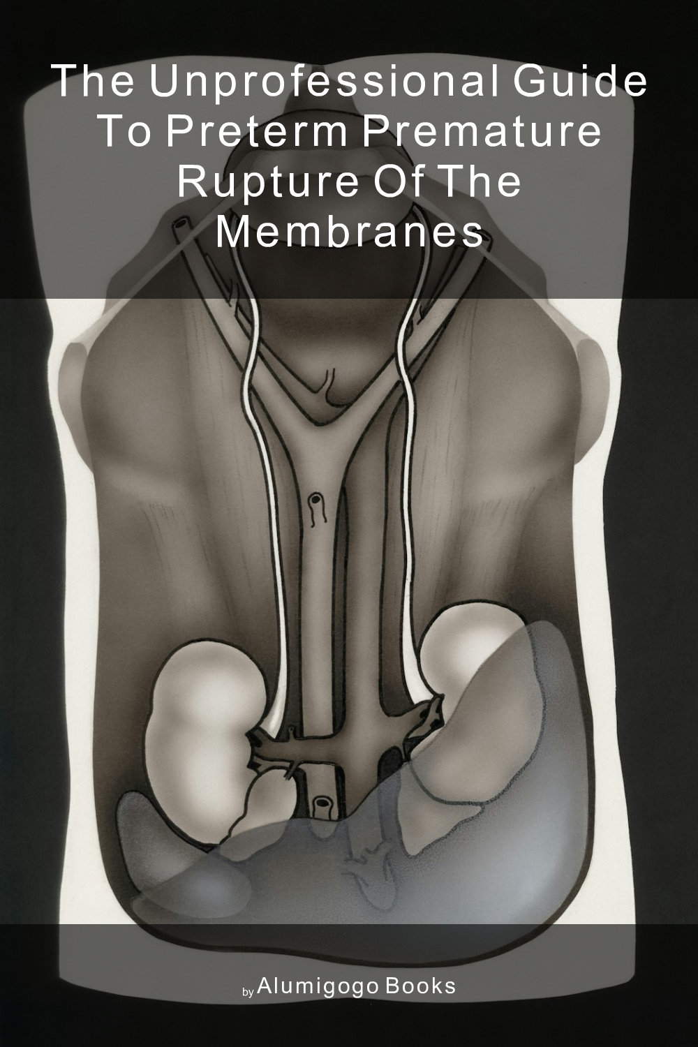 Cover of The Unprofessional Guide to preterm premature rupture of the membranes