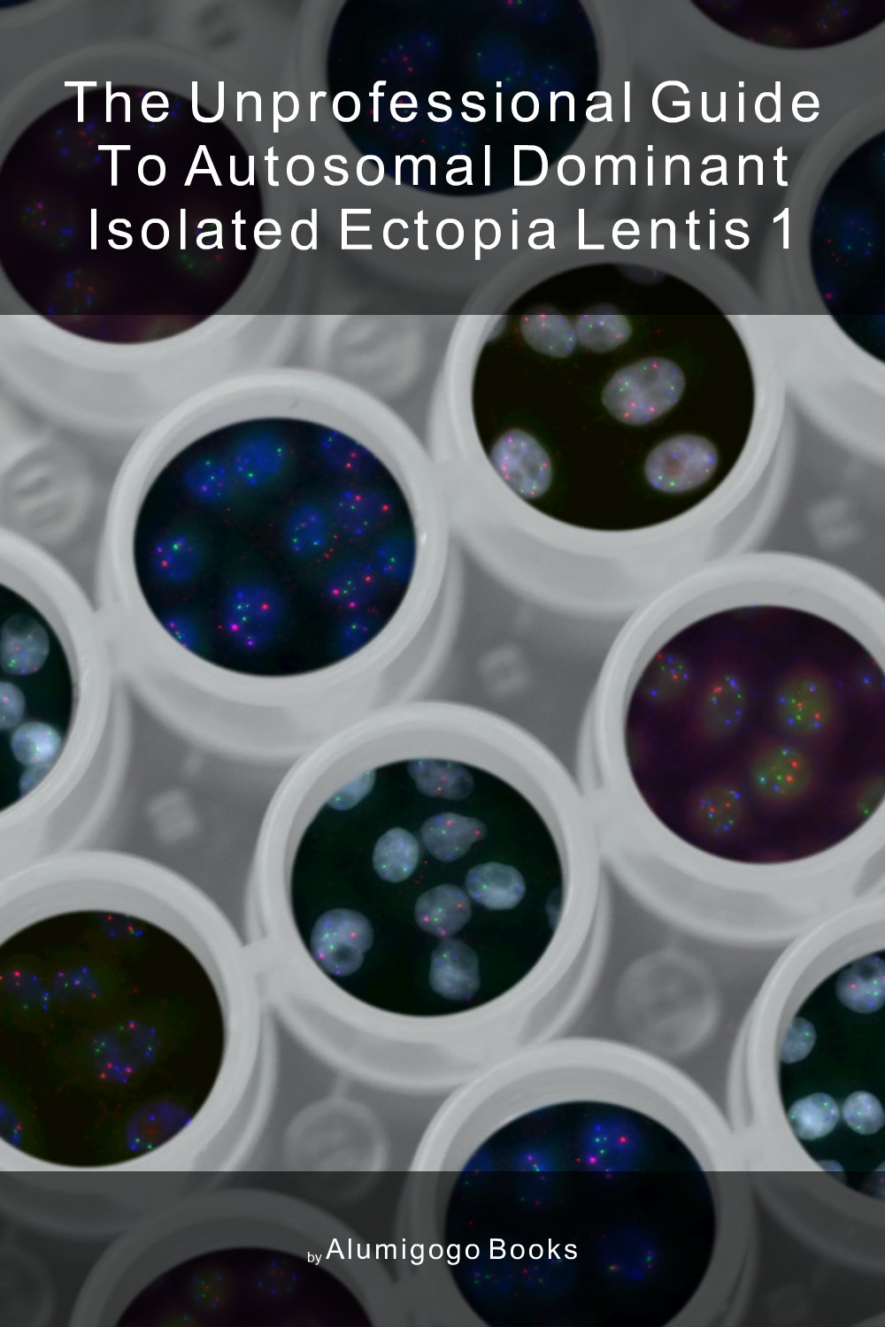Cover of The Unprofessional Guide to autosomal dominant isolated ectopia lentis 1