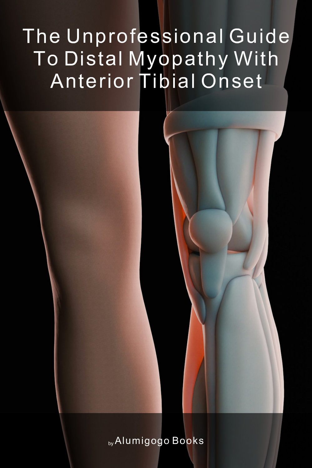 Cover of The Unprofessional Guide to distal myopathy with anterior tibial onset