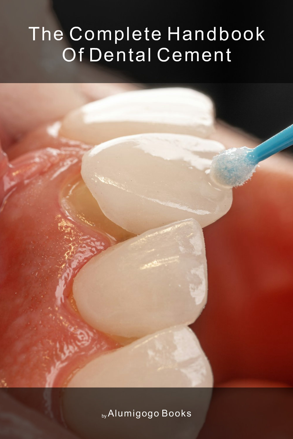 Cover of The Complete Handbook of Dental Cement