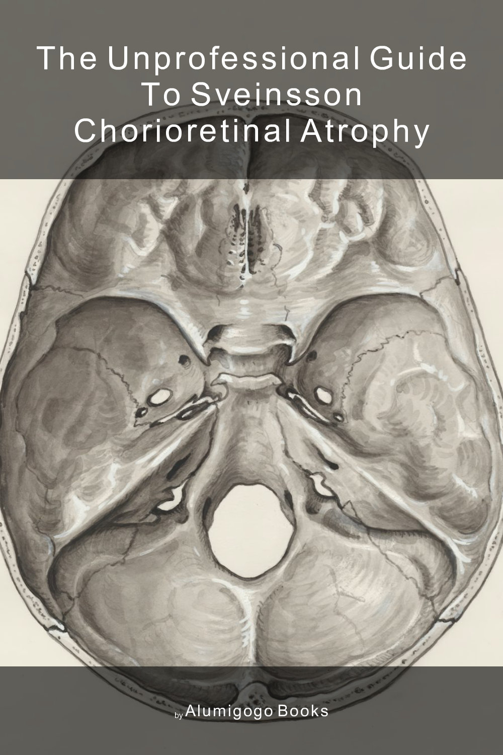Cover of The Unprofessional Guide to Sveinsson chorioretinal atrophy