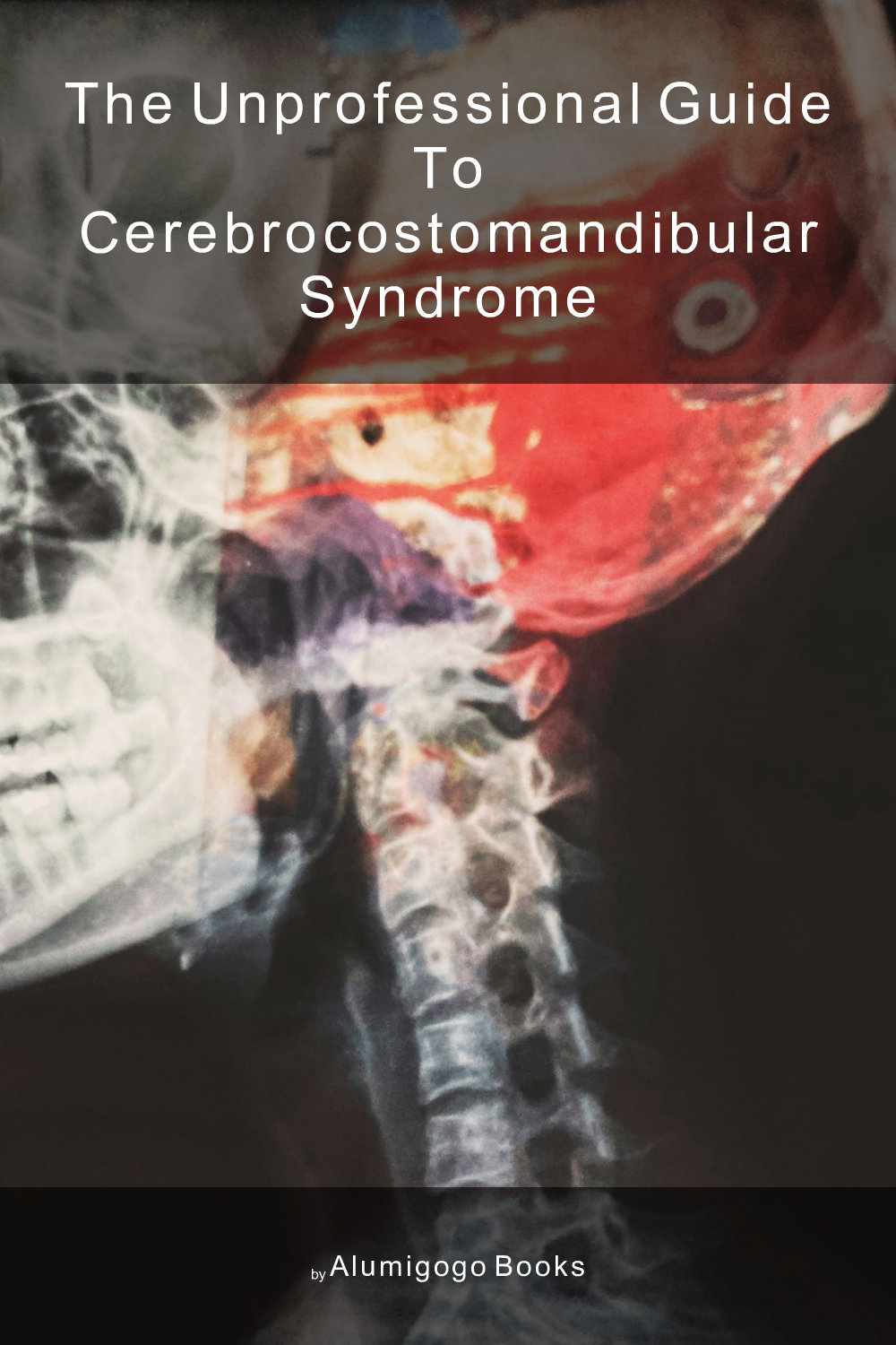 Cover of The Unprofessional Guide to cerebrocostomandibular syndrome