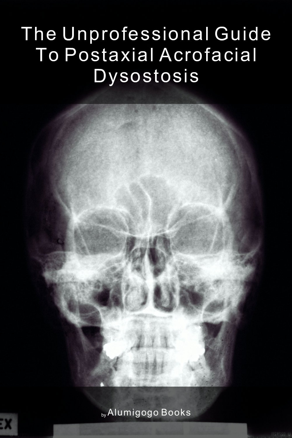 Cover of The Unprofessional Guide to postaxial acrofacial dysostosis