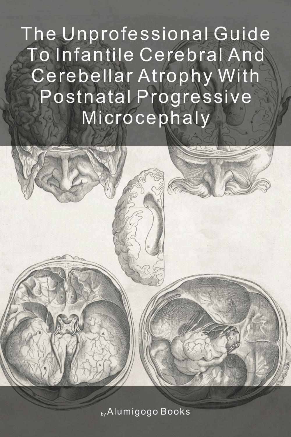 Cover of The Unprofessional Guide to infantile cerebral and cerebellar atrophy with postnatal progressive microcephaly