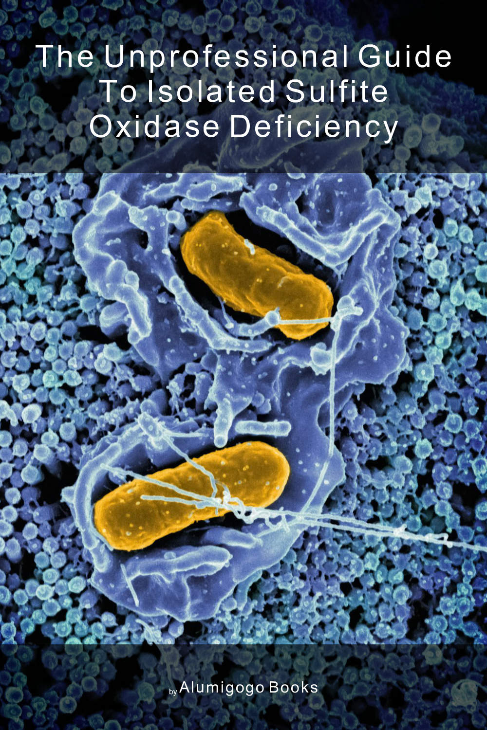 Cover of The Unprofessional Guide to isolated sulfite oxidase deficiency