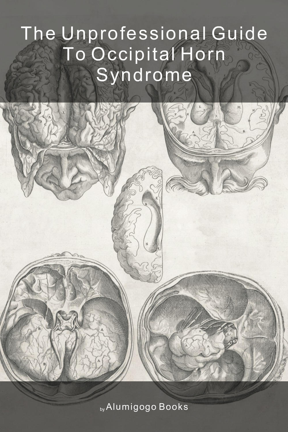 Cover of The Unprofessional Guide to occipital horn syndrome