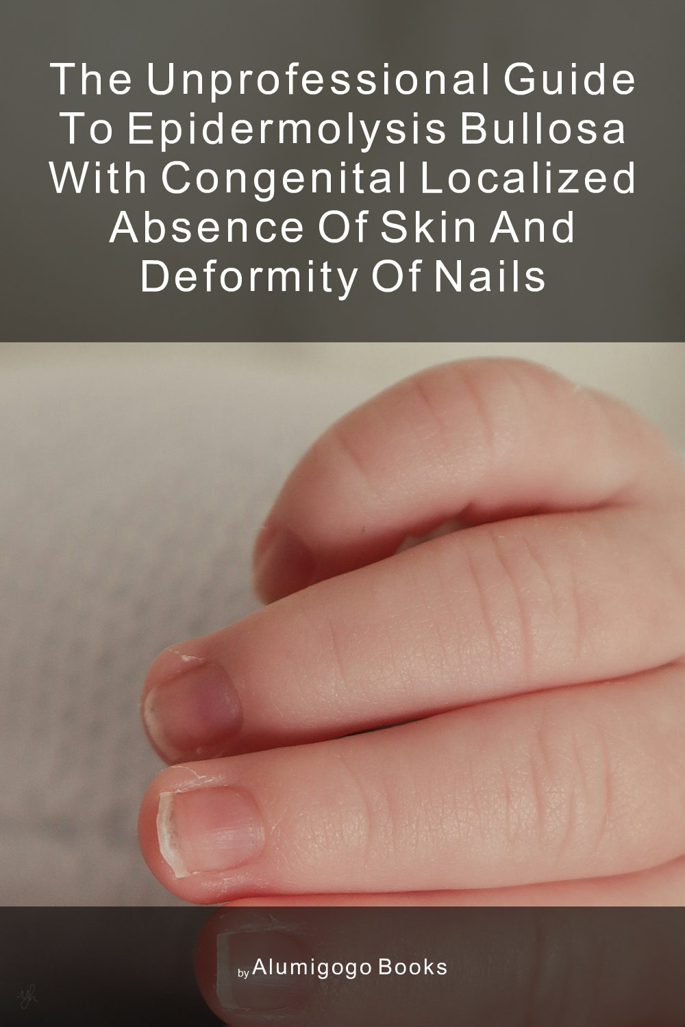 Cover of The Unprofessional Guide to epidermolysis bullosa with congenital localized absence of skin and deformity of nails
