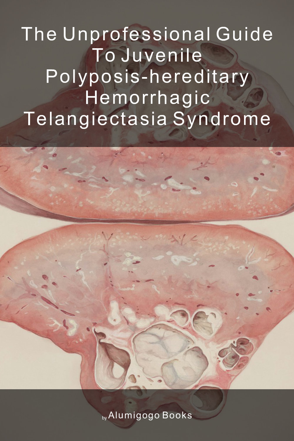Cover of The Unprofessional Guide to juvenile polyposis-hereditary hemorrhagic telangiectasia syndrome