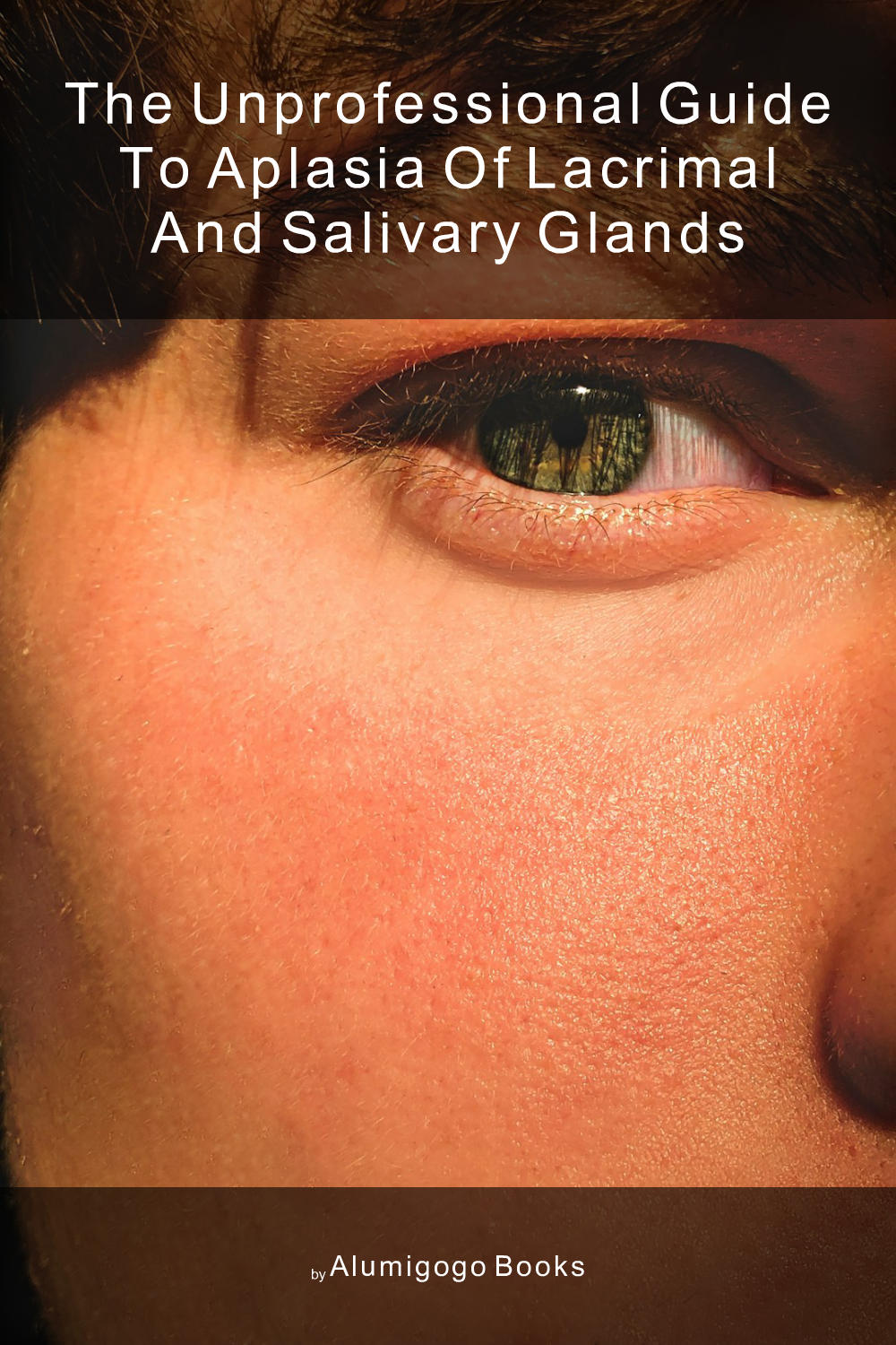 Cover of The Unprofessional Guide to aplasia of lacrimal and salivary glands