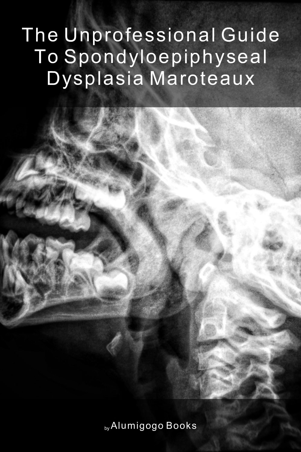 Cover of The Unprofessional Guide to spondyloepiphyseal dysplasia Maroteaux