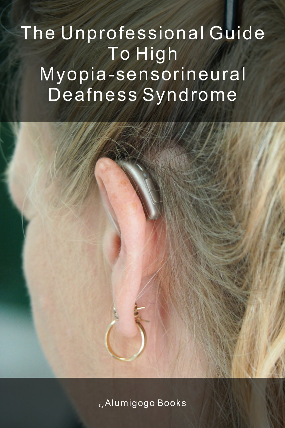 Cover of The Unprofessional Guide to high myopia-sensorineural deafness syndrome
