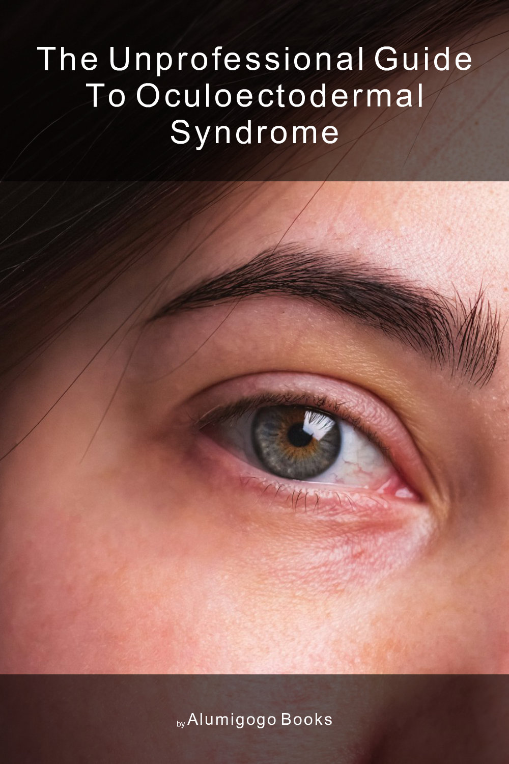 Cover of The Unprofessional Guide to oculoectodermal syndrome