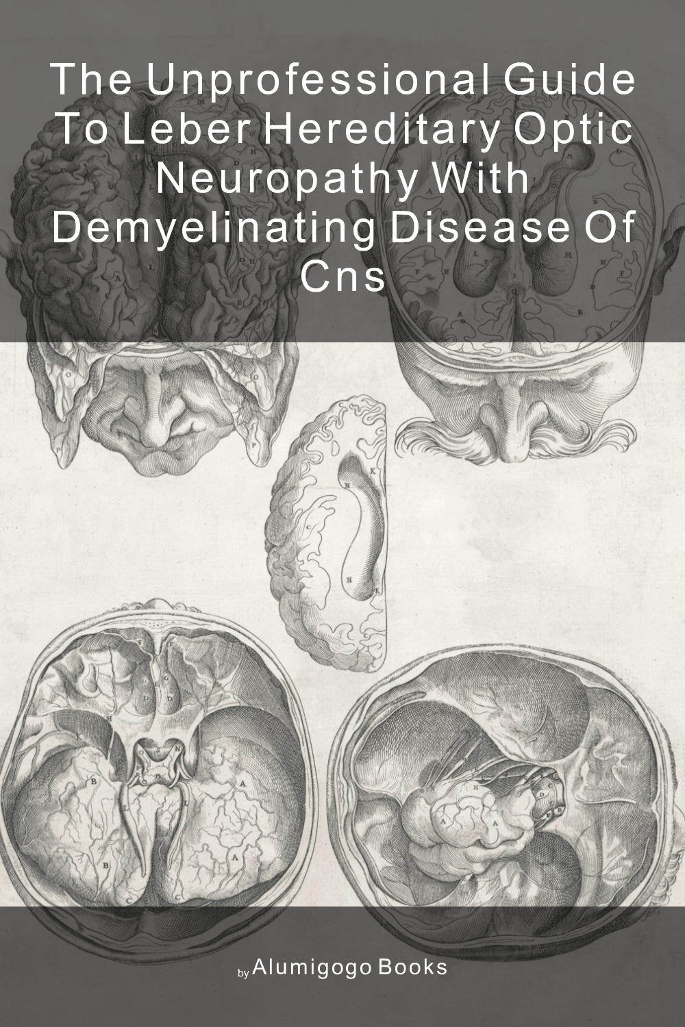 Cover of The Unprofessional Guide to Leber hereditary optic neuropathy with demyelinating disease of CNS