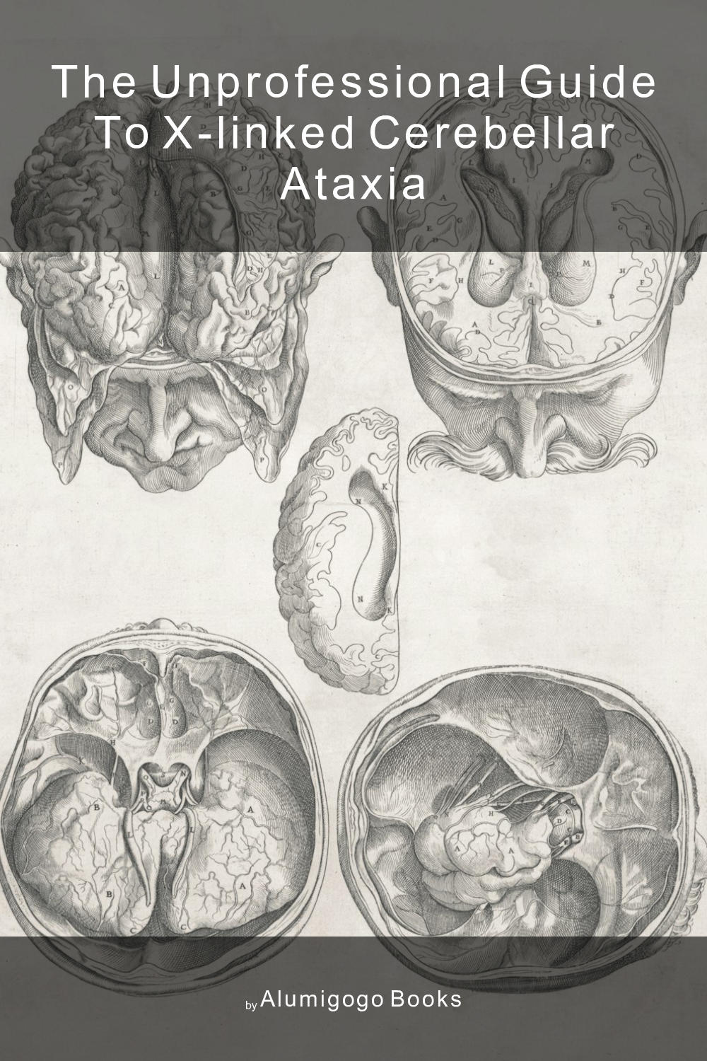 Cover of The Unprofessional Guide to X-linked cerebellar ataxia