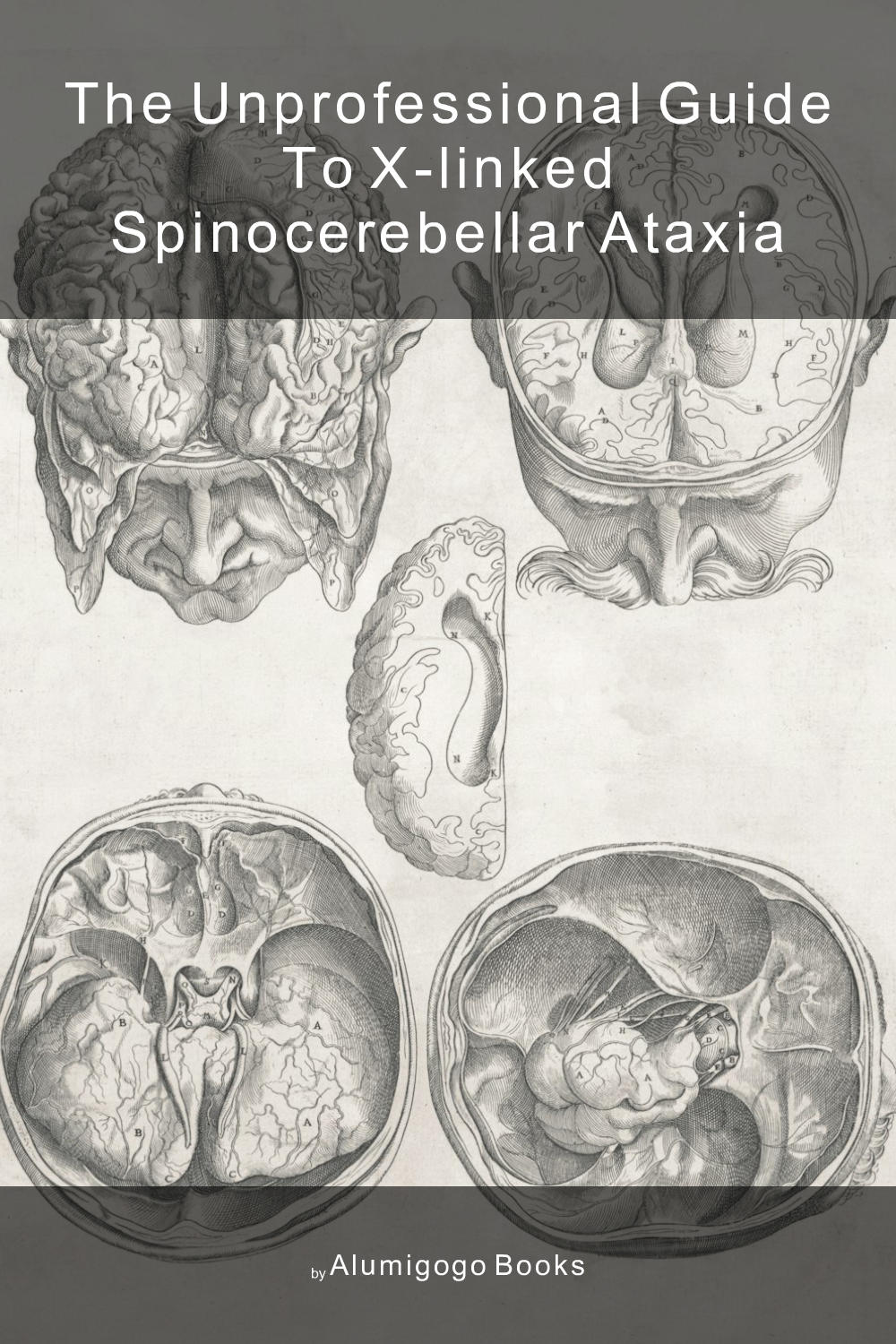 Cover of The Unprofessional Guide to X-linked spinocerebellar ataxia