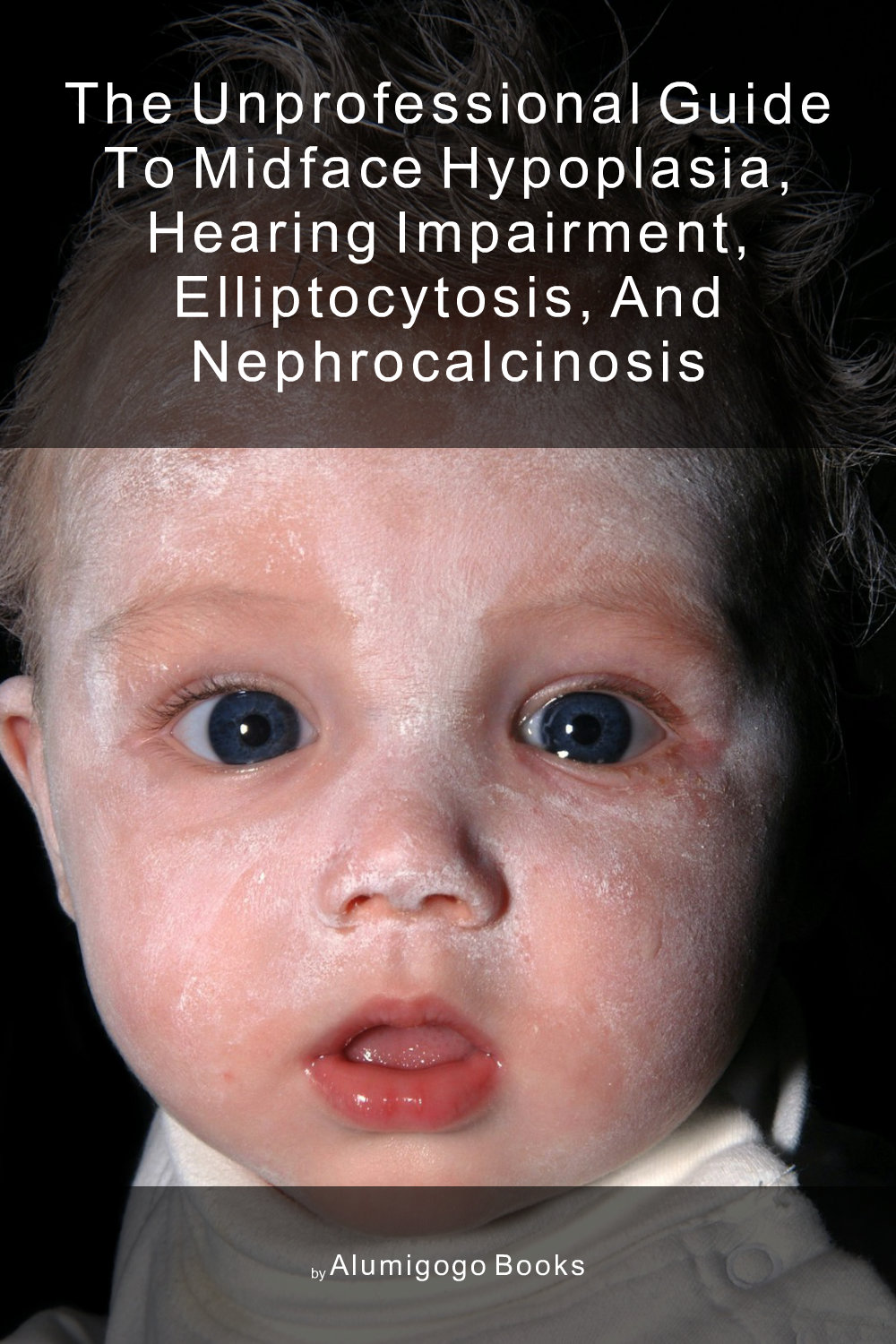 Cover of The Unprofessional Guide to midface hypoplasia, hearing impairment, elliptocytosis, and nephrocalcinosis