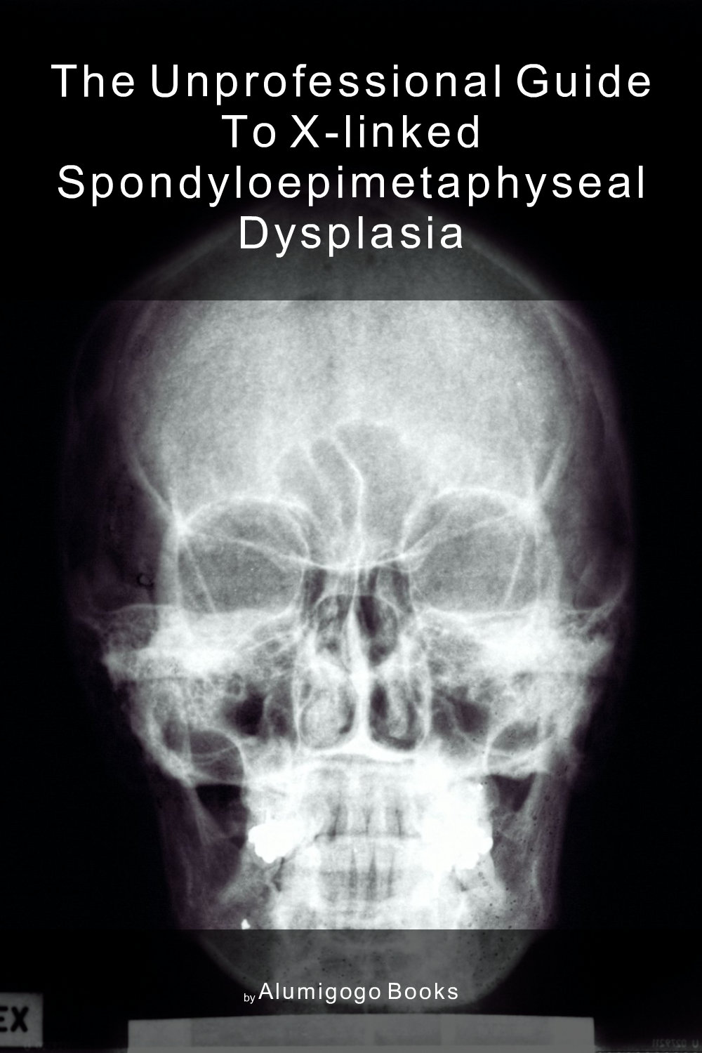 Cover of The Unprofessional Guide to X-linked spondyloepimetaphyseal dysplasia