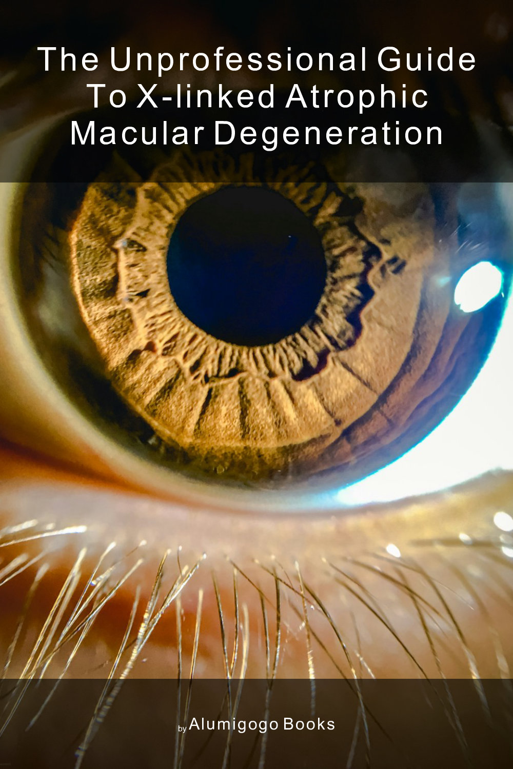 Cover of The Unprofessional Guide to X-linked atrophic macular degeneration