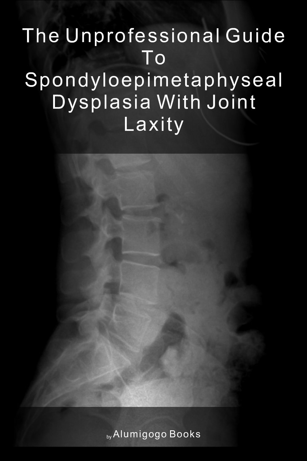 Cover of The Unprofessional Guide to spondyloepimetaphyseal dysplasia with joint laxity