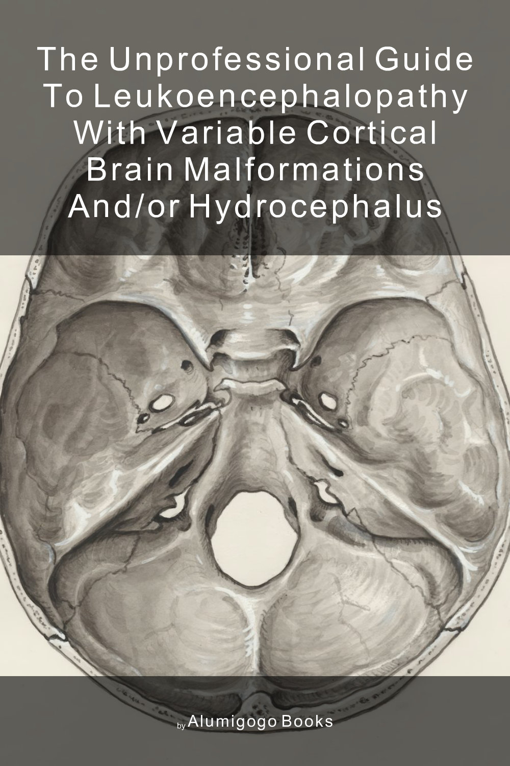 Cover of The Unprofessional Guide to leukoencephalopathy with variable cortical brain malformations and/or hydrocephalus