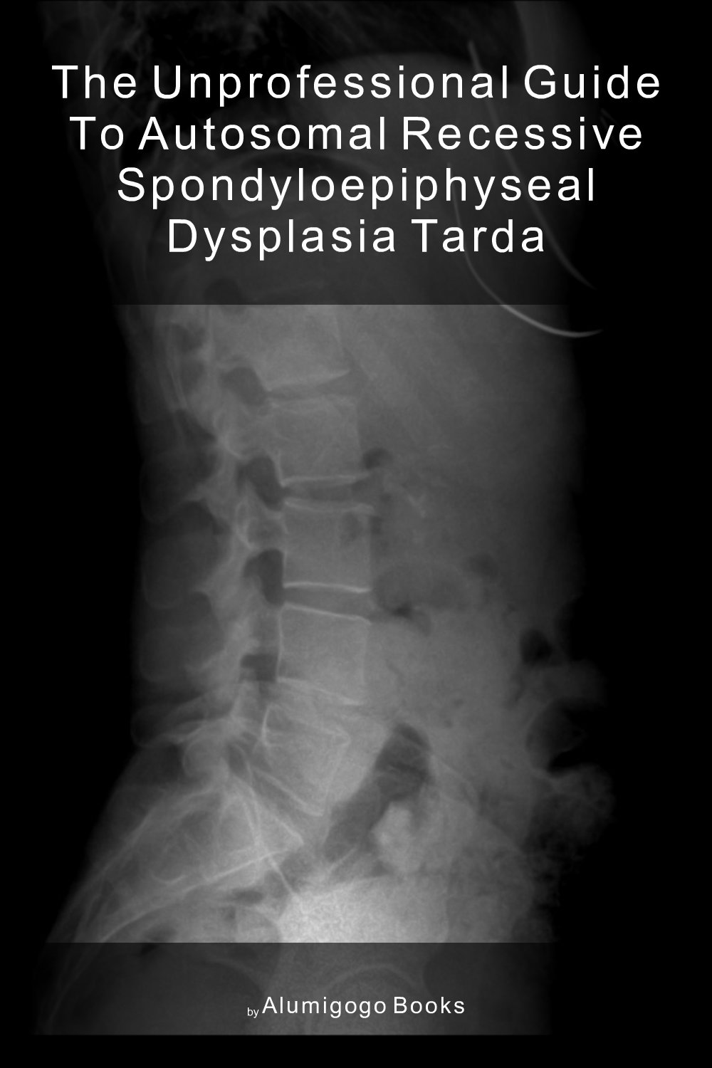 Cover of The Unprofessional Guide to autosomal recessive spondyloepiphyseal dysplasia tarda