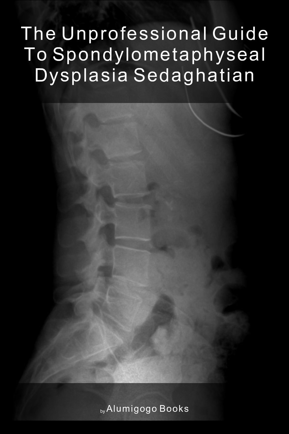 Cover of The Unprofessional Guide to spondylometaphyseal dysplasia Sedaghatian